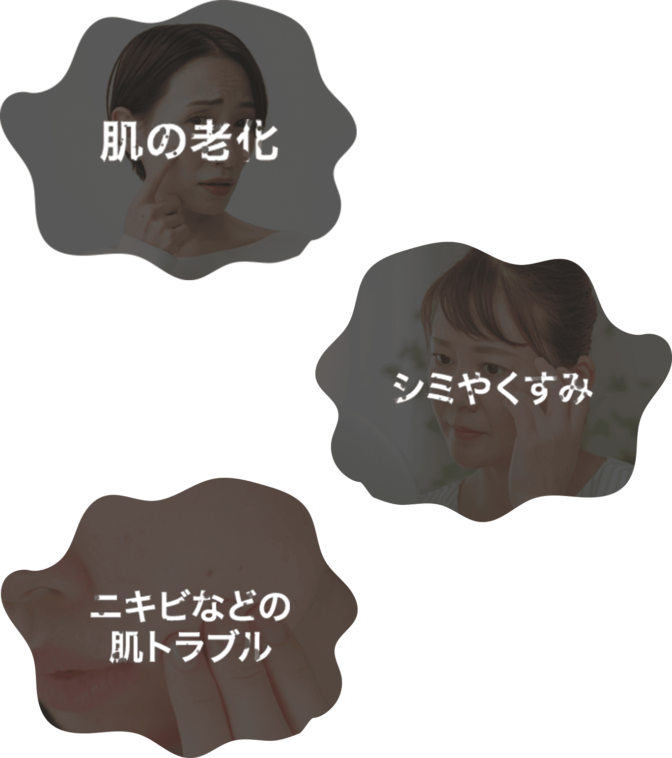 肌の老化・シミやくすみ・ニキビなどの肌トラブル